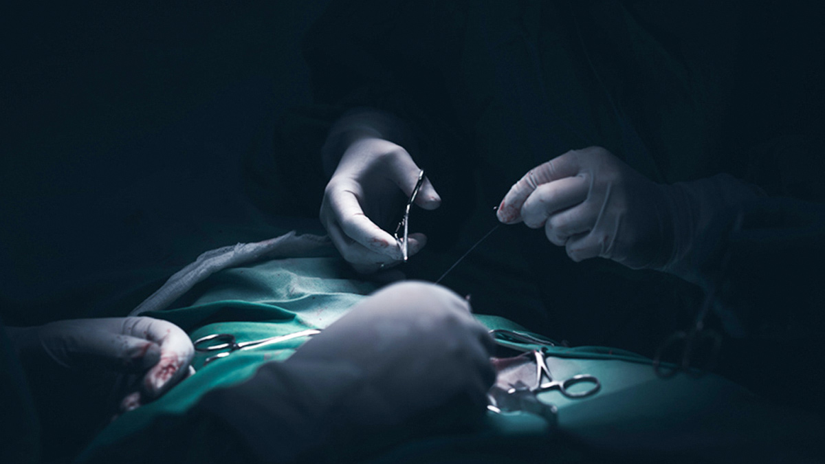 2-surgical-infection