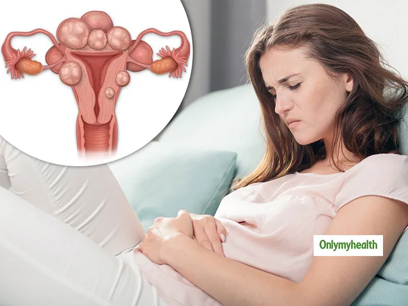 Can Uterine Problems Affect Fertility? Expert Answers
