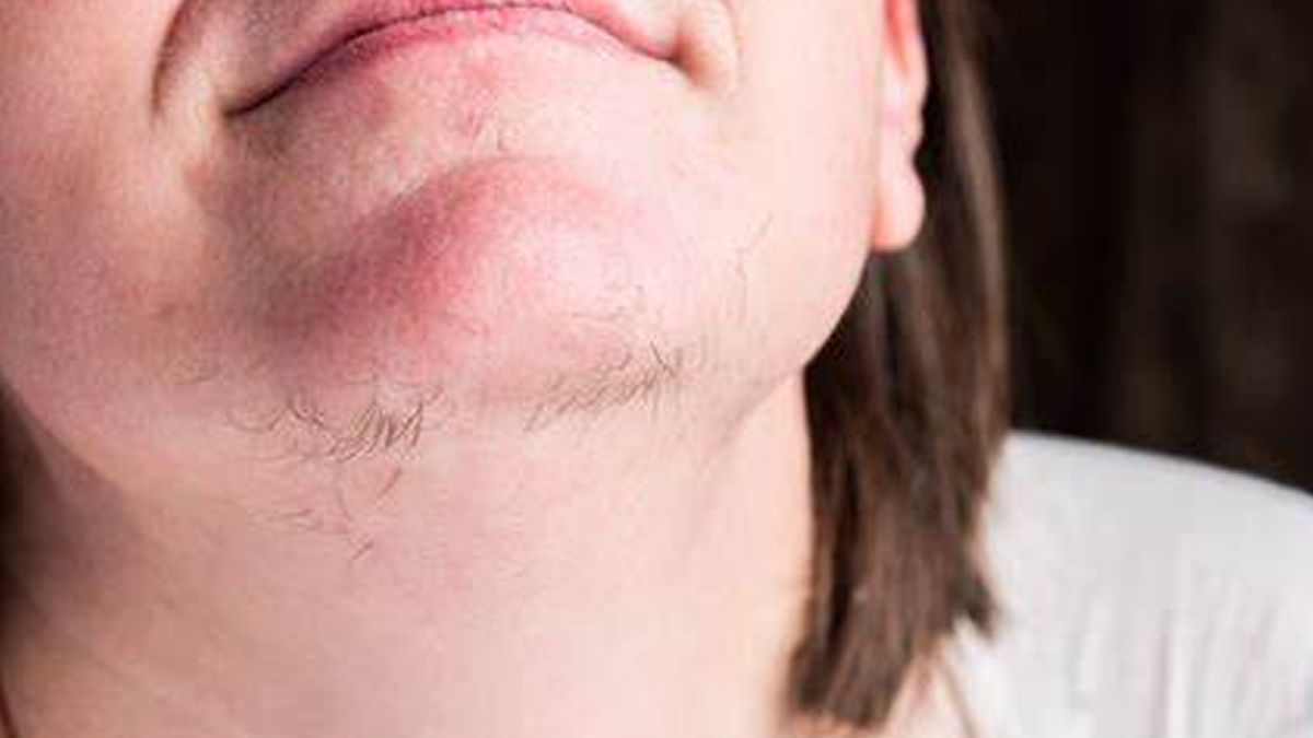 difference-between-normal-and-abnormal-hair-growth