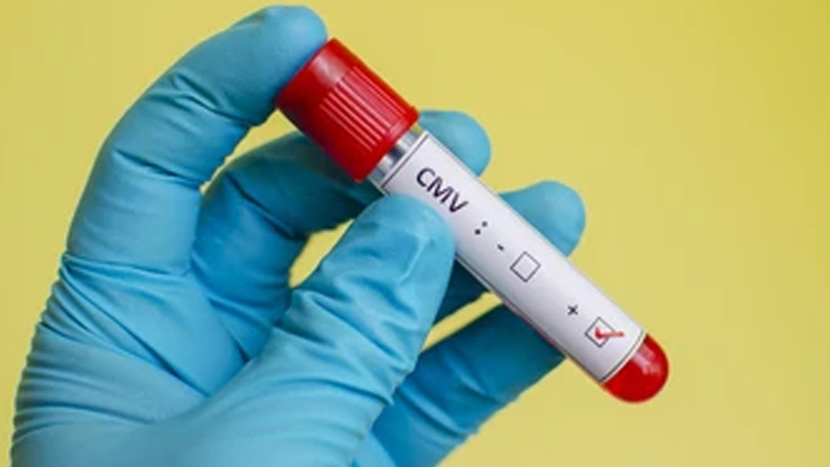 CMV-blood-test