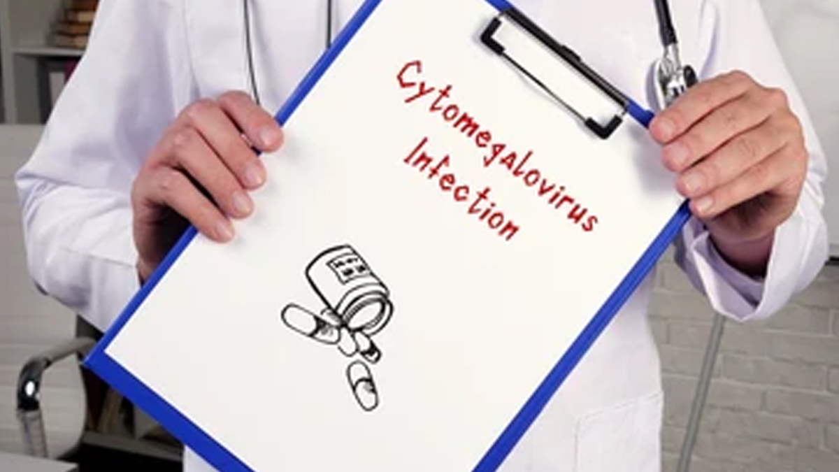 cytomegalovirus-infection