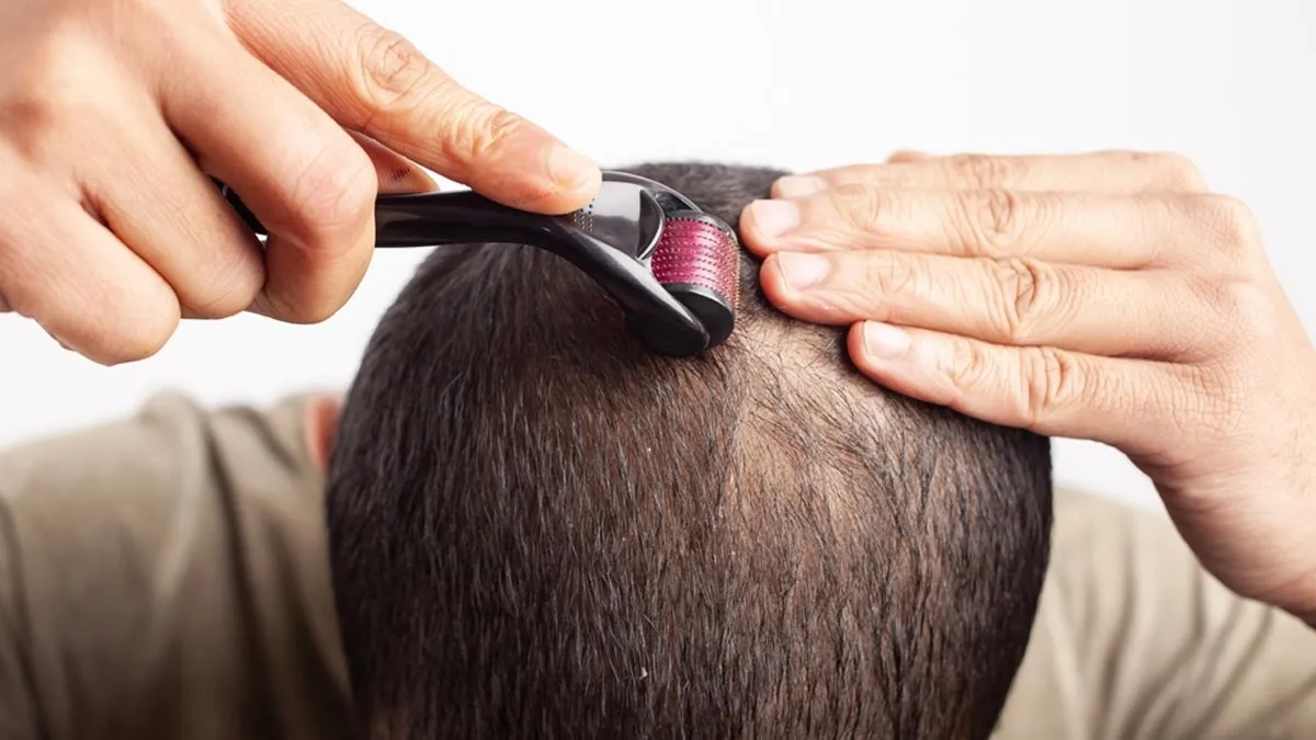 Can Derma Rollers Promote Hair Growth? Find Out From The Expert