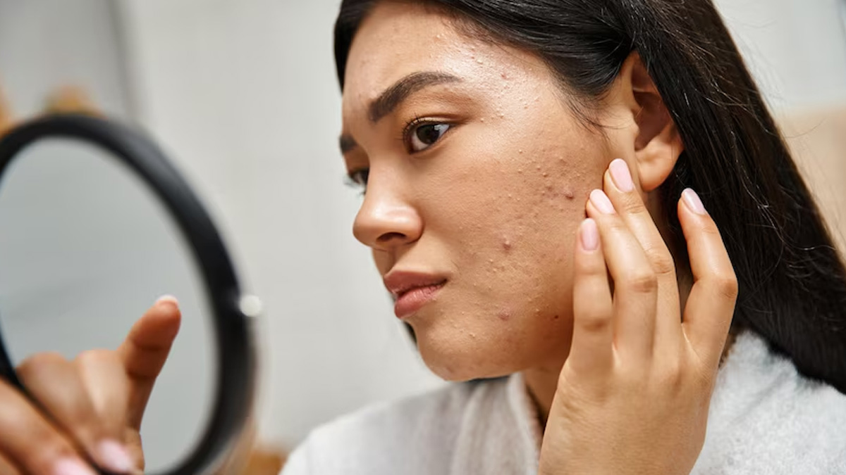 1-skin-problems-pregnancy