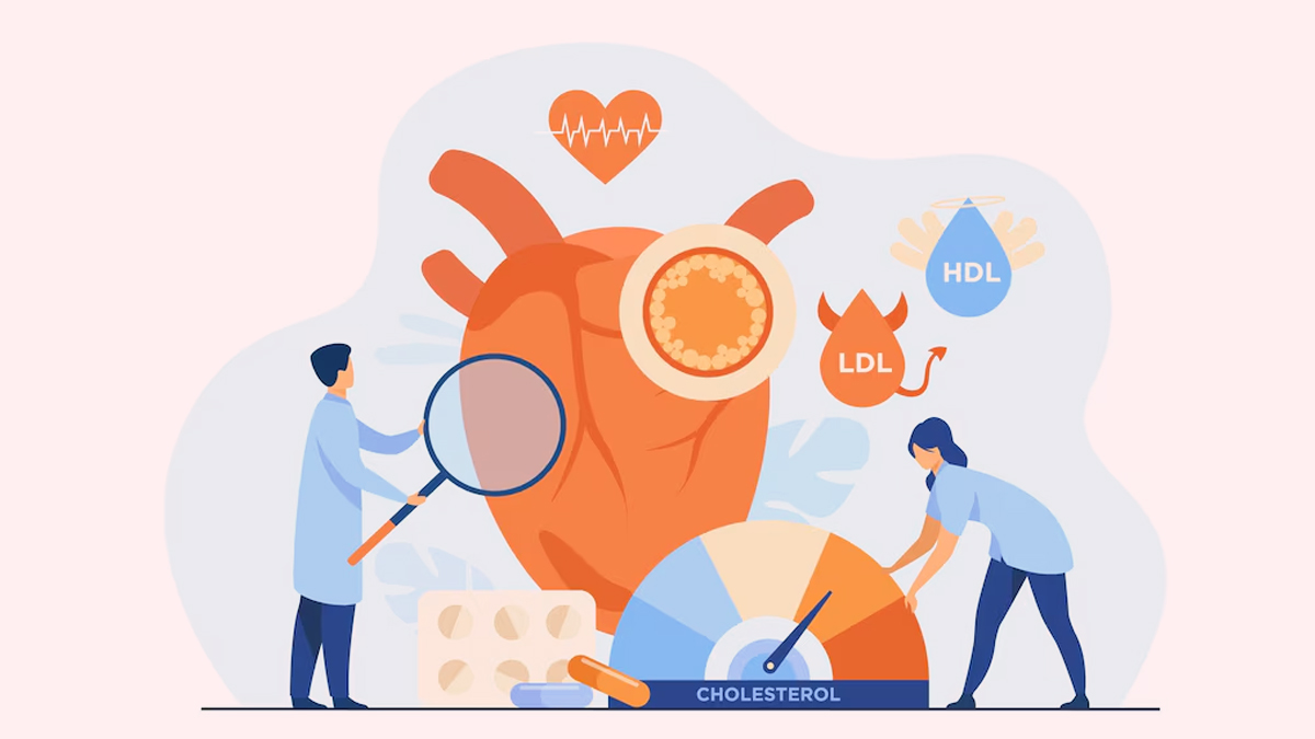 cholesterol-levels