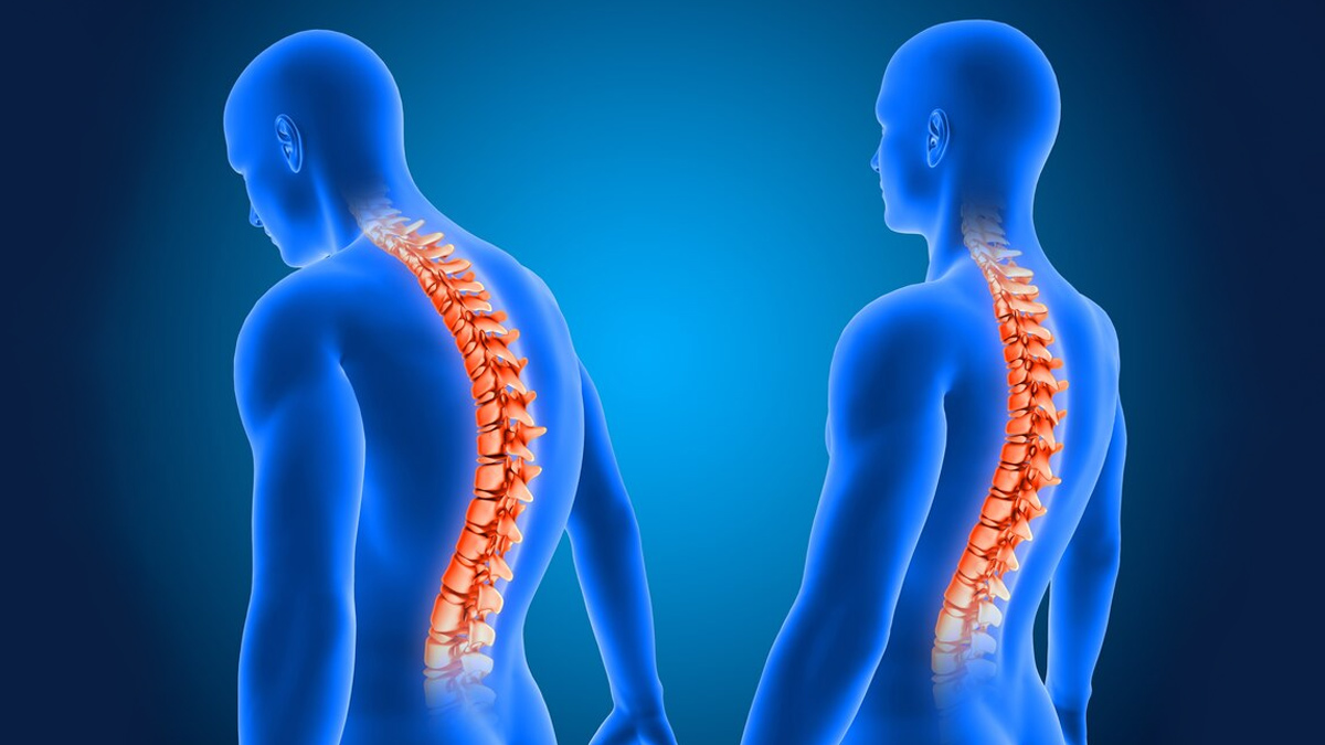 spine-health