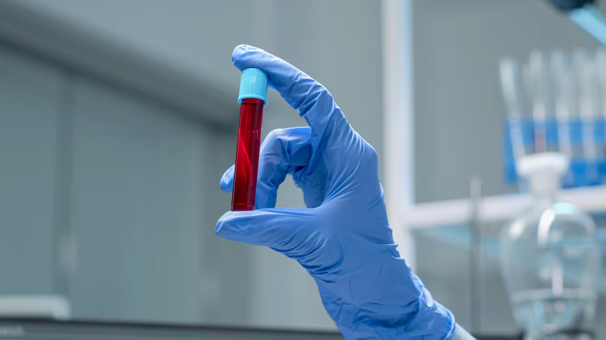 2 _Anaemia