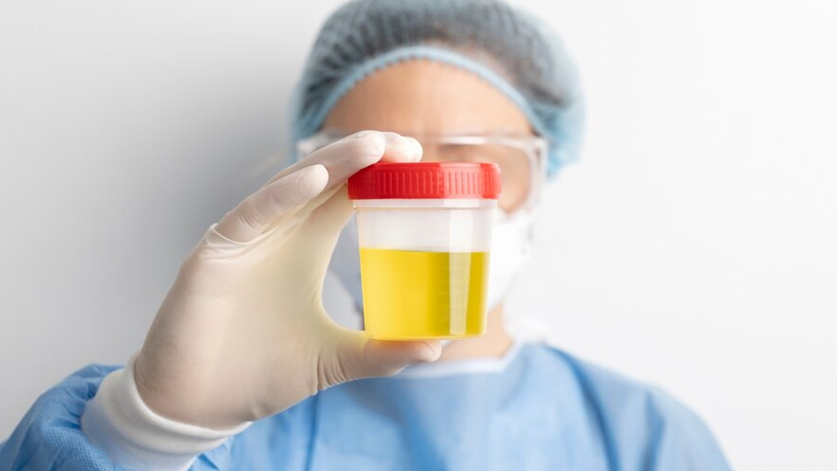 What It Means To Have Bubbles In Your Urine: When You Should Worry?