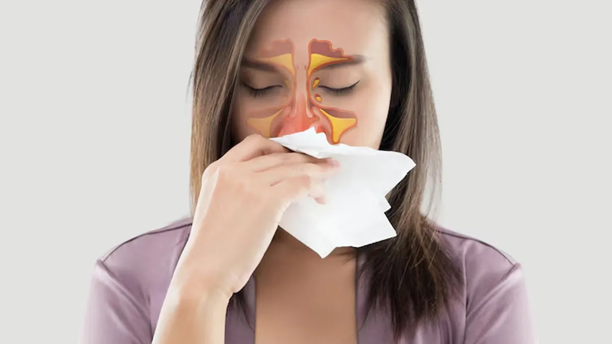 Common Cold Or Sinusitis? Expert Explains How To Find Out If Your Cold Has Become A Sinus Infection