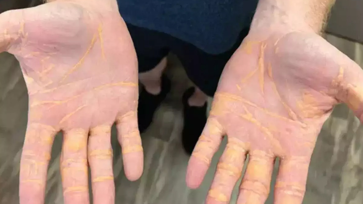 1-anti-inflammatory-diet