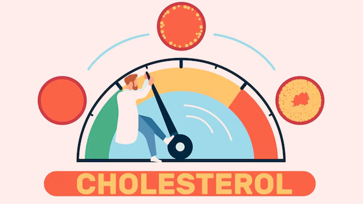 cholesterol