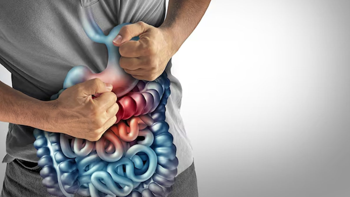 IBS Can Cause Both Constipation And Diarrhoea: Expert Explains Why This Happens And How To Manage It