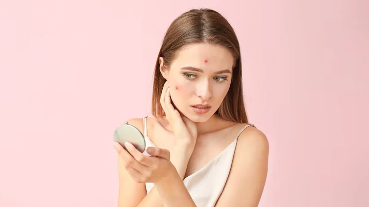 Winter Acne: Understanding Causes, Prevention, and Treatment Strategies