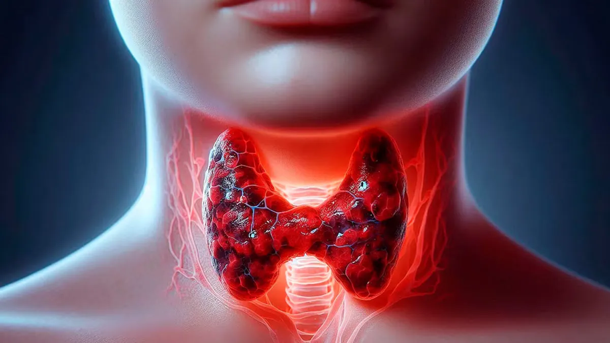 Link Between Anxiety And Thyroid Cancer: Expert Explains If You Are At Risk