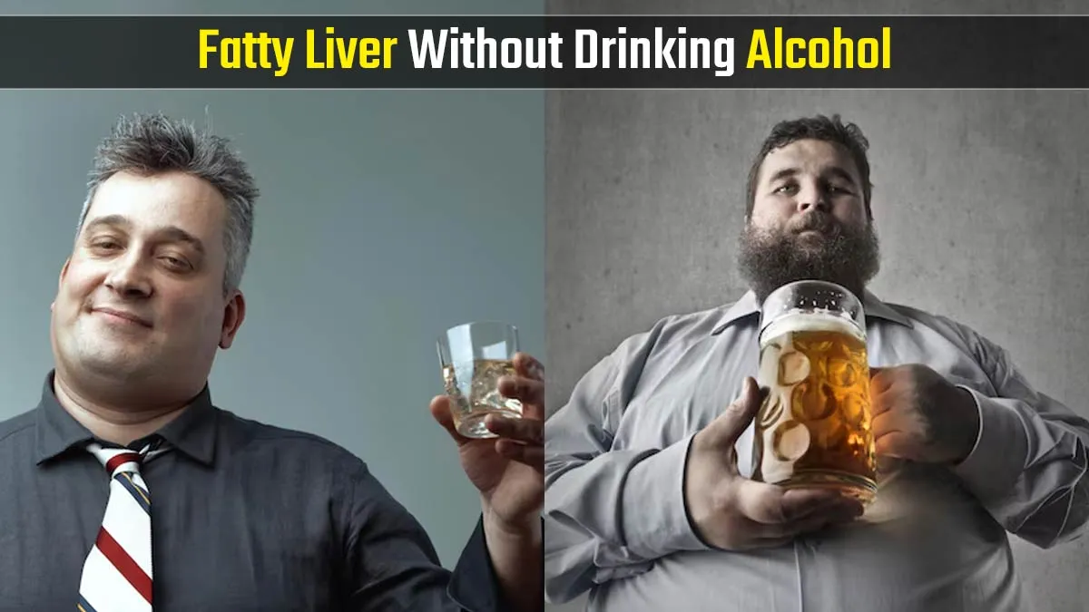 How You Might Have a Fatty Liver Even If You Don’t Drink Alcohol: Liver Specialist Shares Causes and Treatment