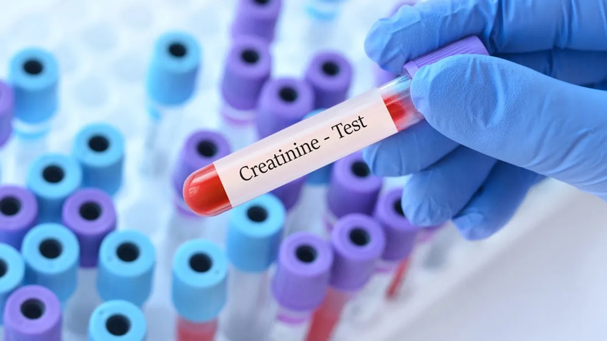 High Vs. Low Creatinine Levels: What Do Each Reveal And Signs To Identify Them?