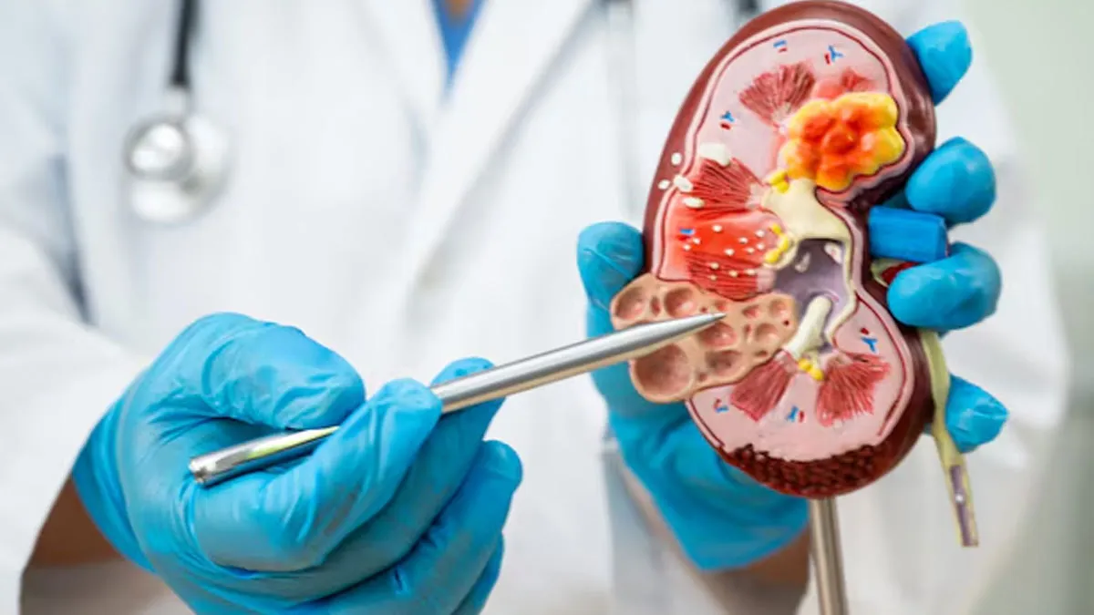From Uncontrollable High Blood Pressure To Persistent Fatigue: Expert Lists 7 Signs Of Kidney Disease Getting Worse
