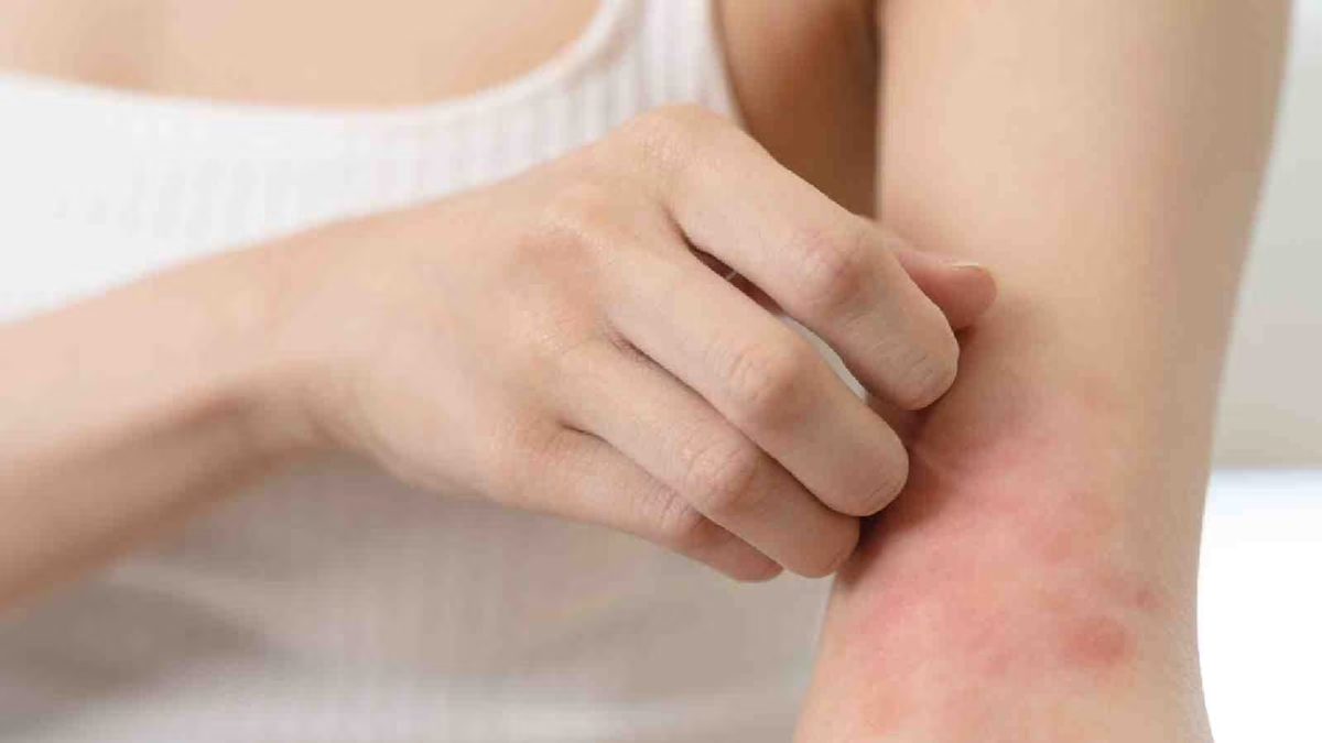 3-pollution-rash