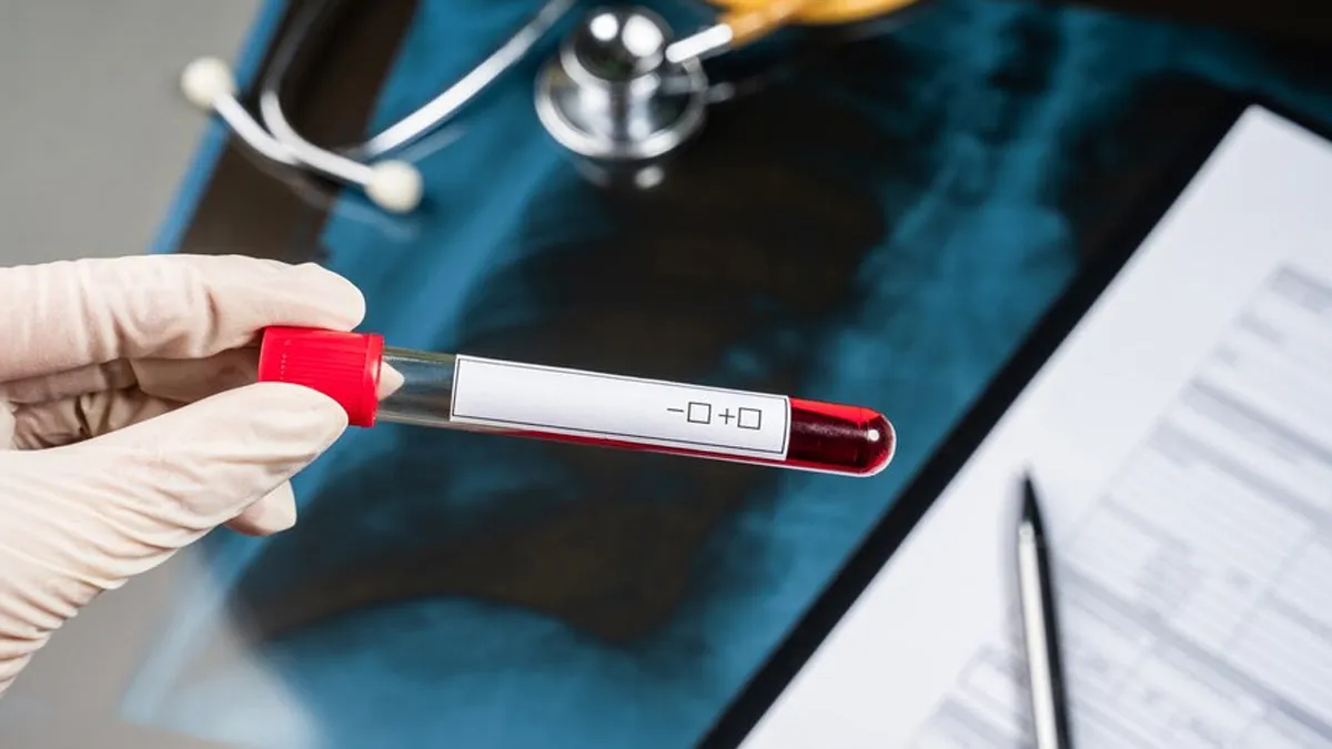 When Should You Test For Inflammation? Types Of Test Available