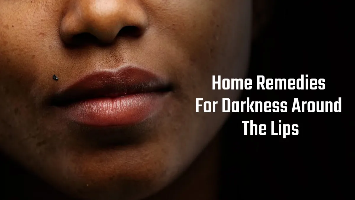 Hyperpigmentation Causing Darkness Around Lips? Try These Home Remedies To Get Rid of It