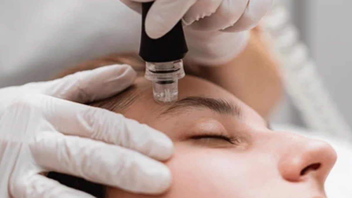 Microdermabrasion