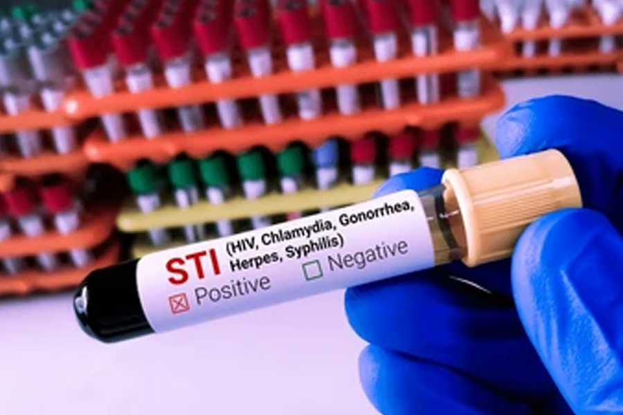 sexually-transmitted-infections