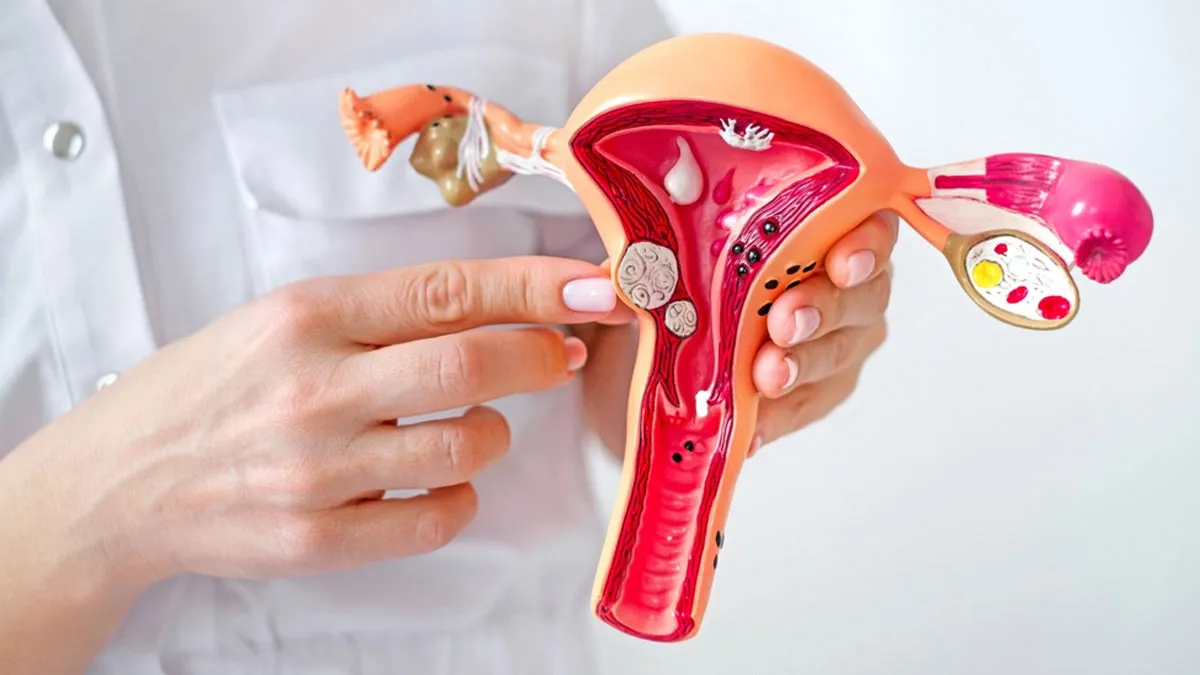 Less Pain, More Relief: The New Era Of Fibroid Treatment Through Intervention Radiology
