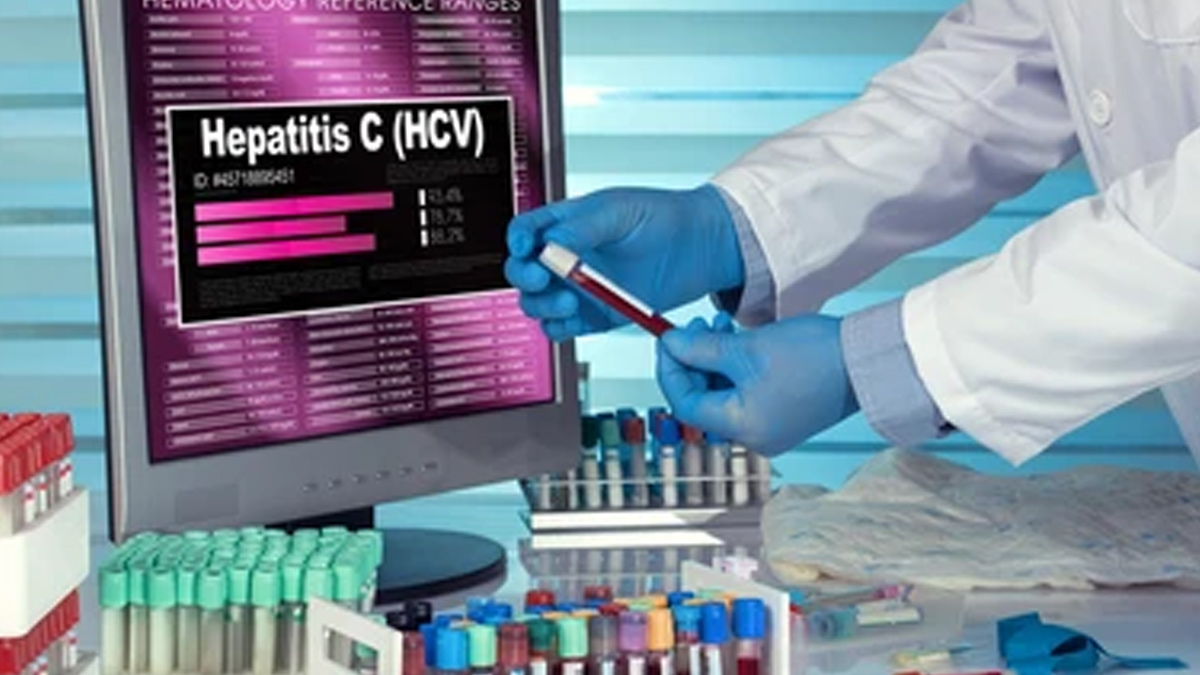Hepatitis-screening