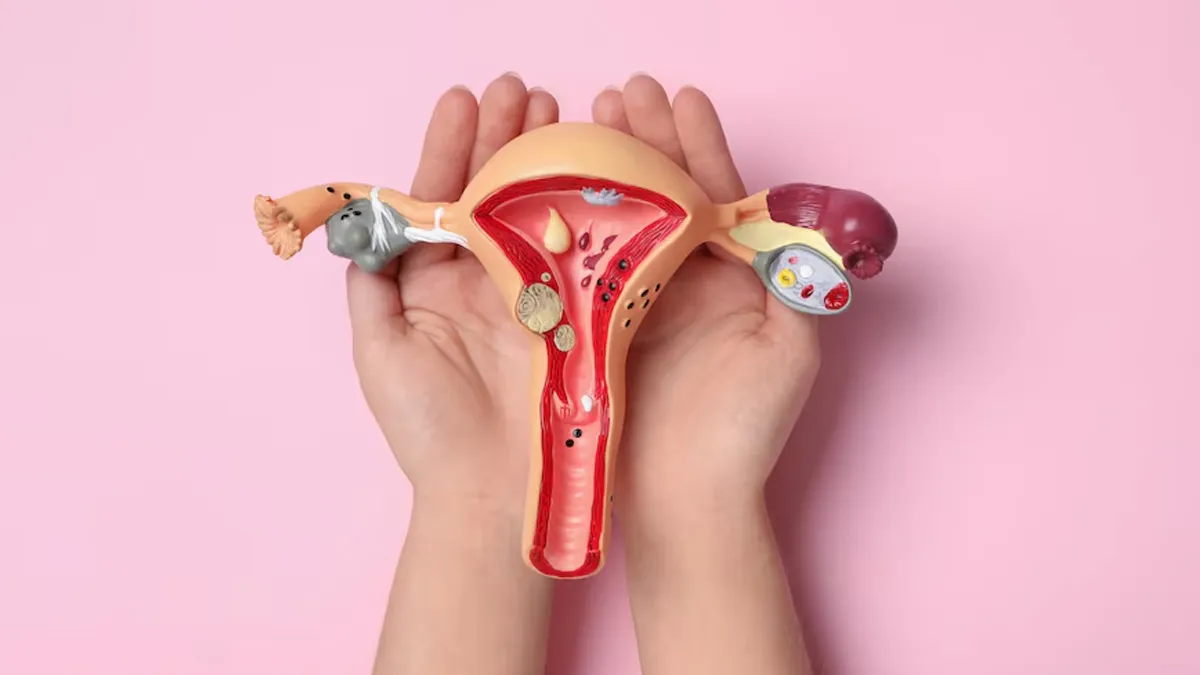 Cervical Cancer Prevention: How Maintaining Personal Hygiene Can Reduce The Risk