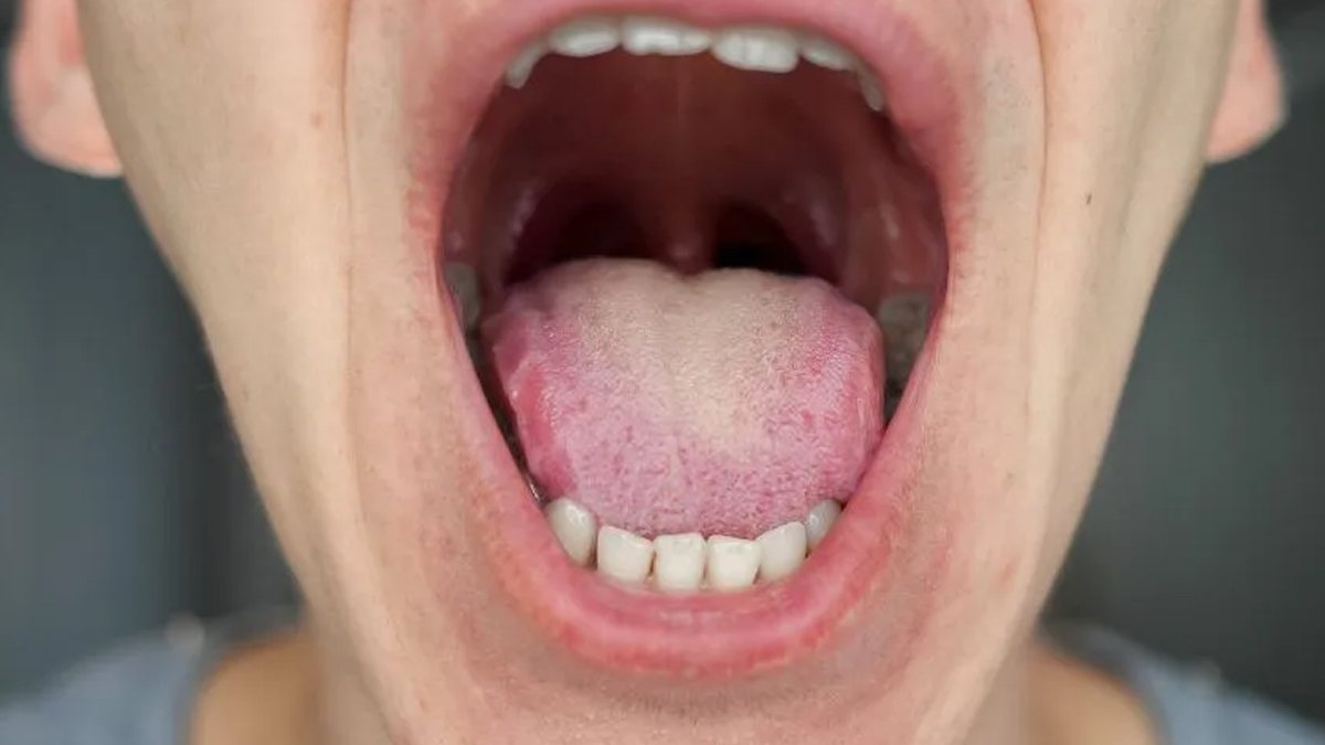 2-dehydration
