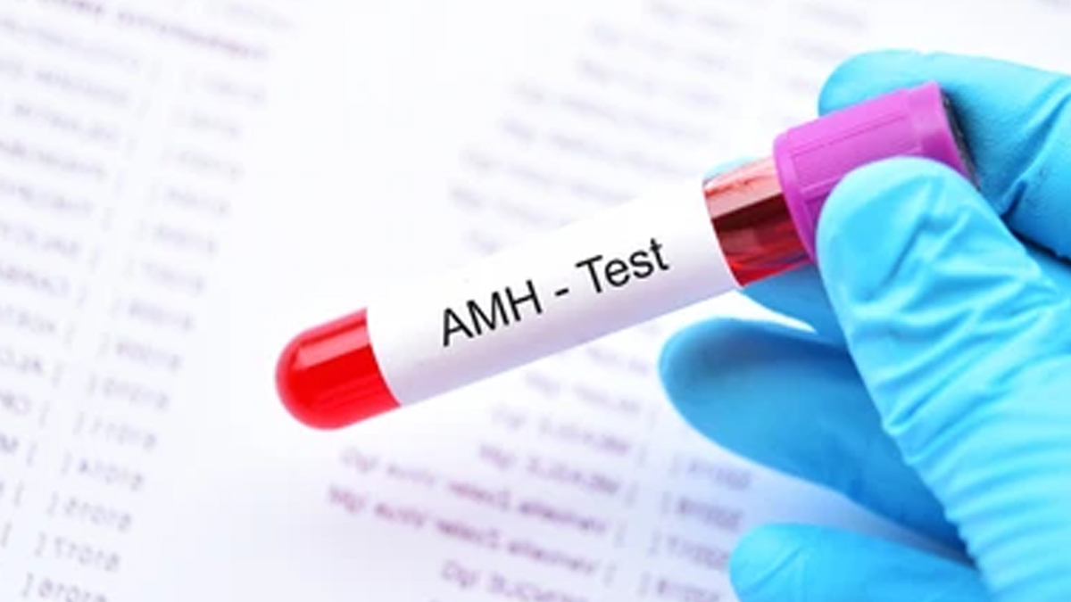 AMH-test