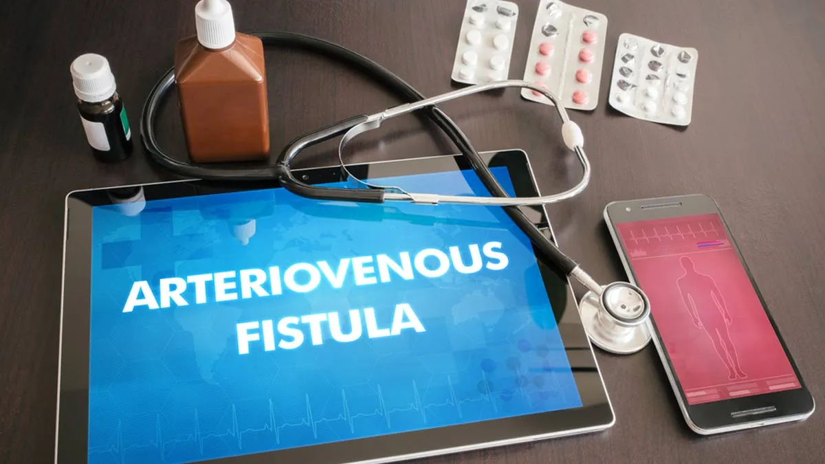 Preparing For Dialysis? Here’s Why An Arteriovenous (AV) Fistula Is The Best Choice