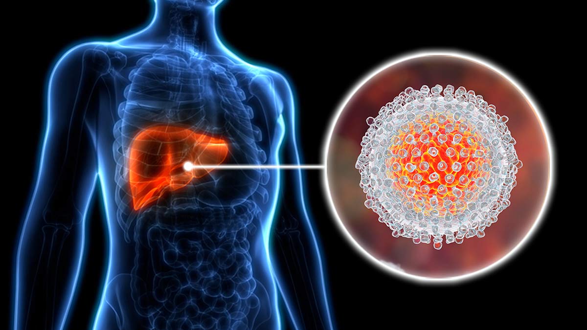 Hepatitis C Outbreak Hits Uttarakhand Village With 100+ Cases—How Does It Spread?