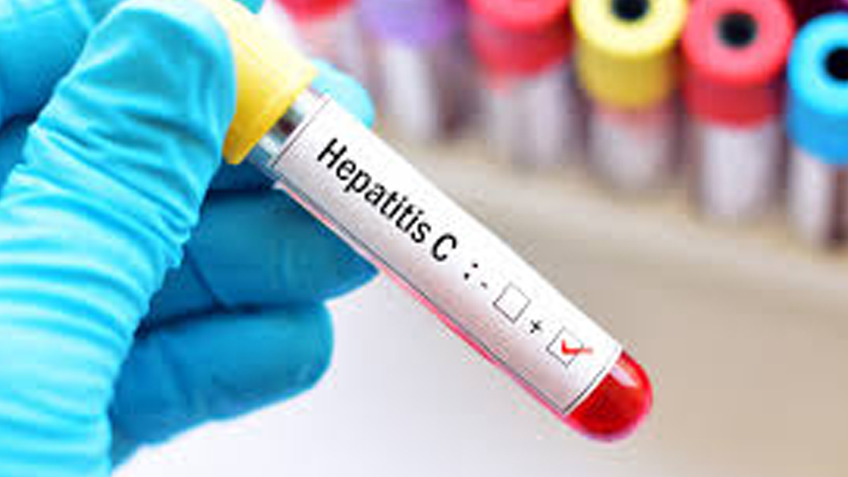 2-HepC