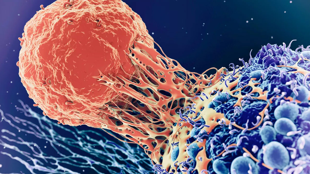 1-cancer (2)