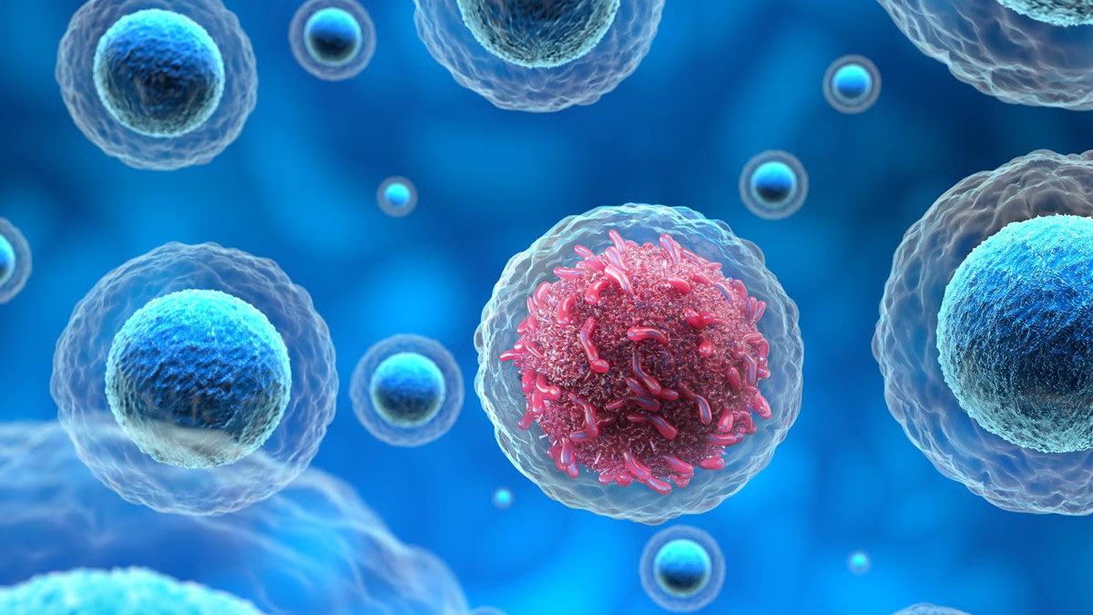 2-cancer (2)
