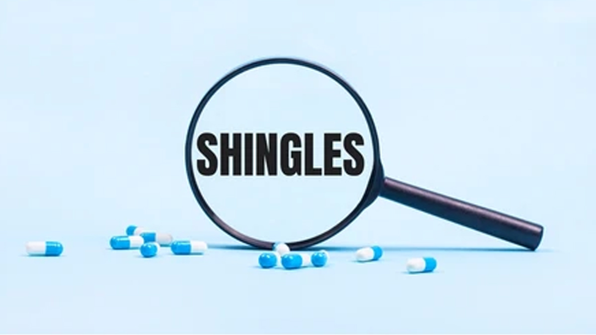 shingles-disease