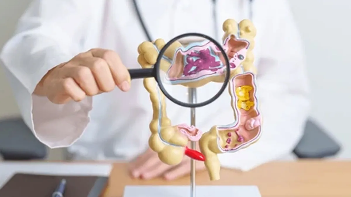 7 Pitfalls That Can Exacerbate Ulcerative Colitis Symptoms