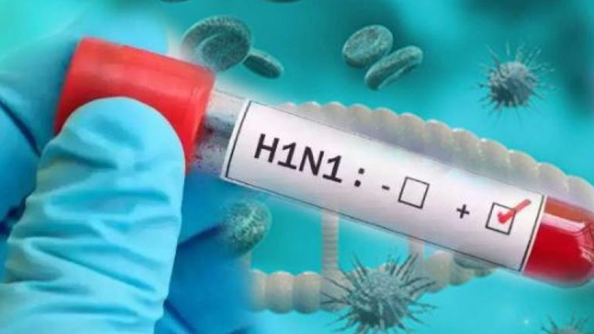 2-swine-flu
