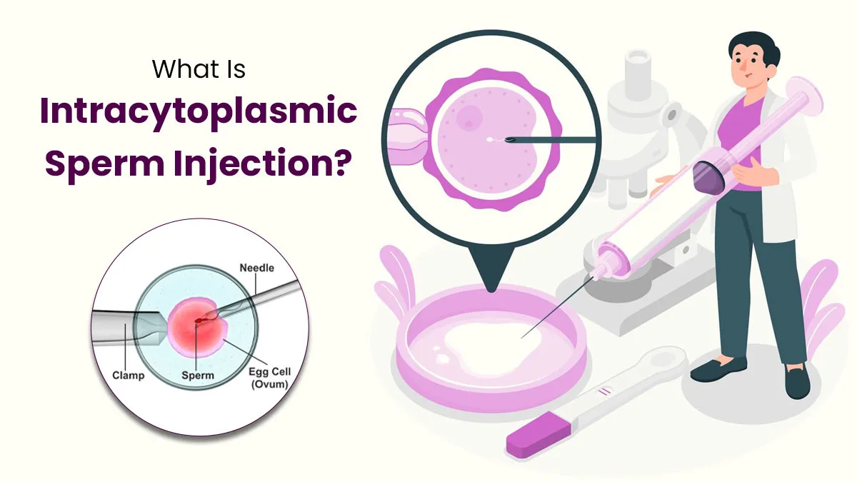 What Is Intracytoplasmic Sperm Injection (ICSI)? Expert Details The IVF Fertility Treatment