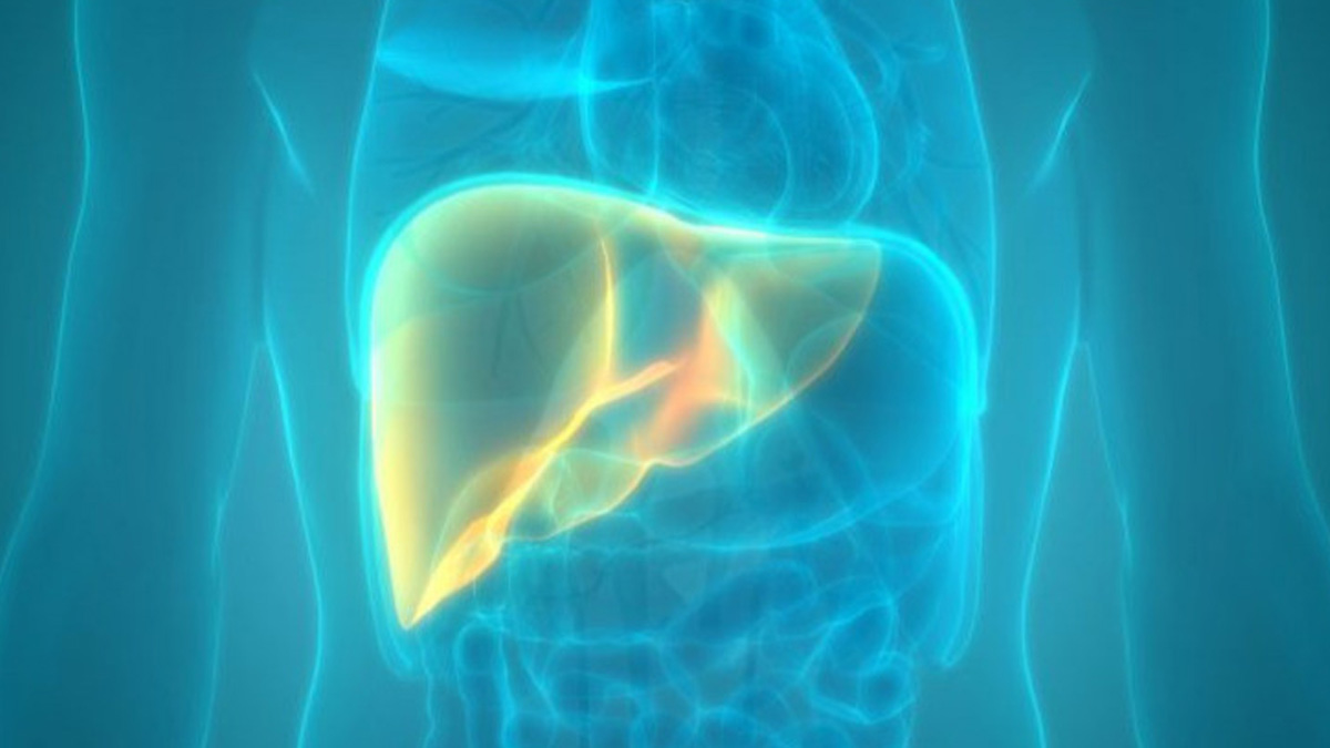 3-fatty-liver