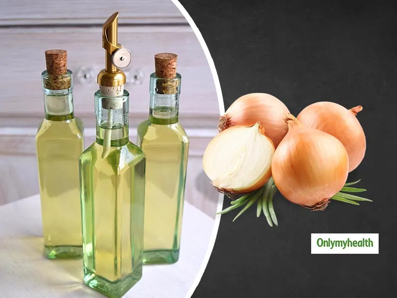Instagram Leads or Misleads? Can Onion Oil Really Help Reduce Hair Fall? Find Out Here