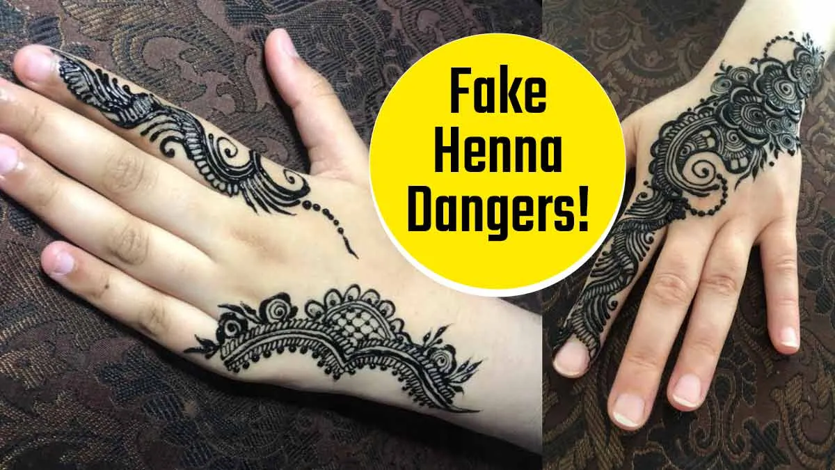 Is Black Mehendi Safe for Your Skin? Expert Breaks Down the Risks of Fake Henna