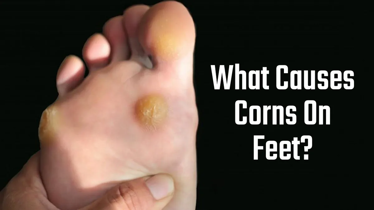 What Is The Main Cause of Corns on Feet? Expert Shares the Prevention Tips