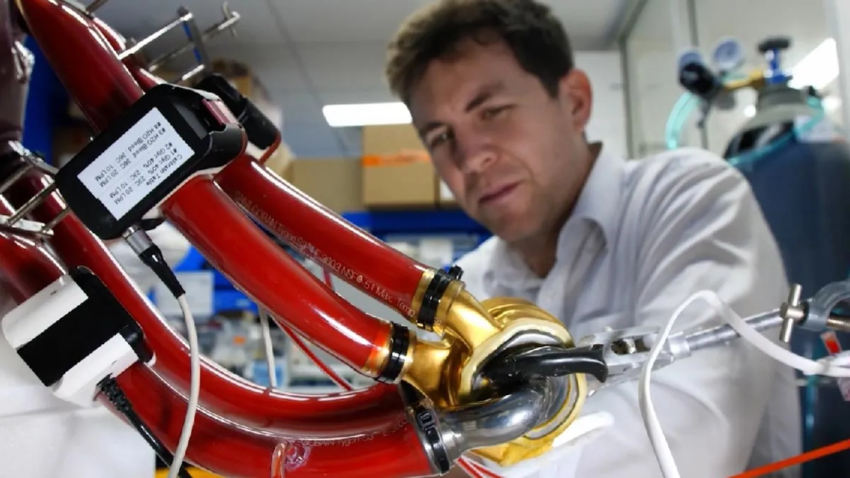 Australian Man Makes Medical History, Survives 100 Days With Artificial Heart In Groundbreaking Trial