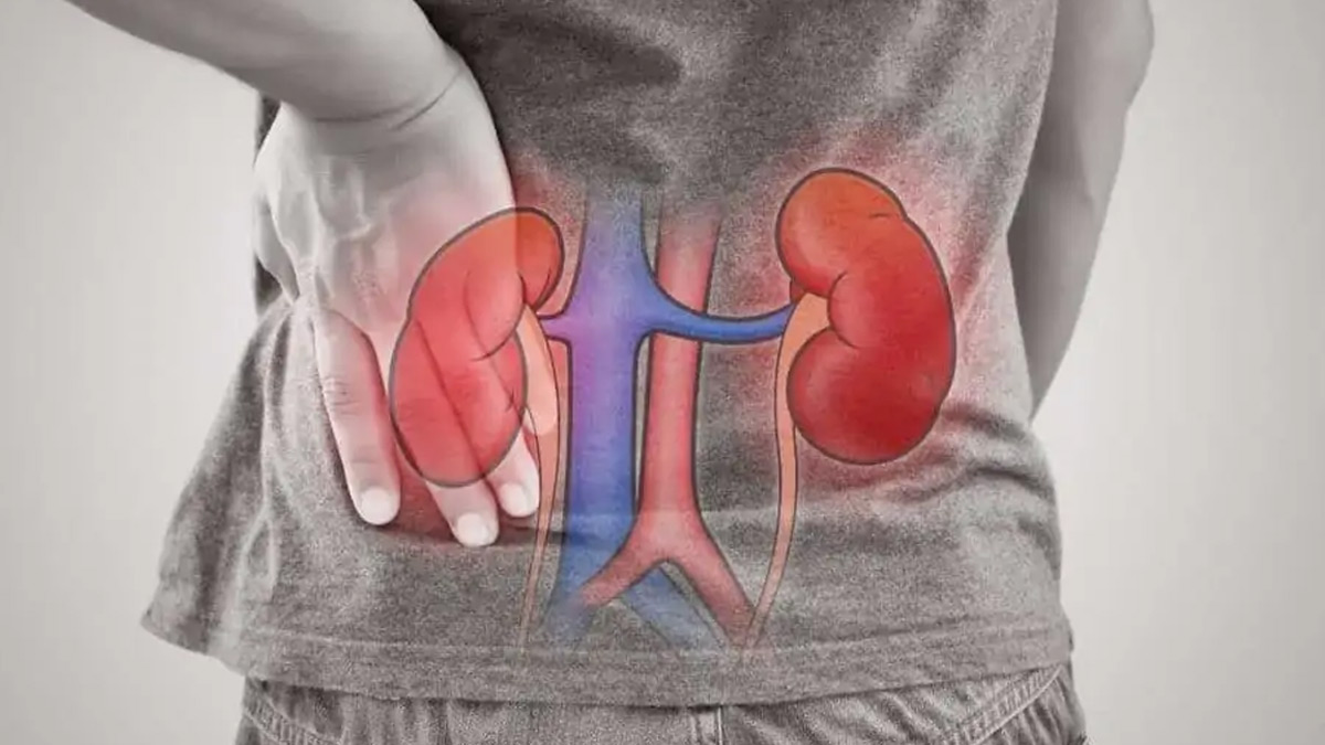 2-kidney-failure
