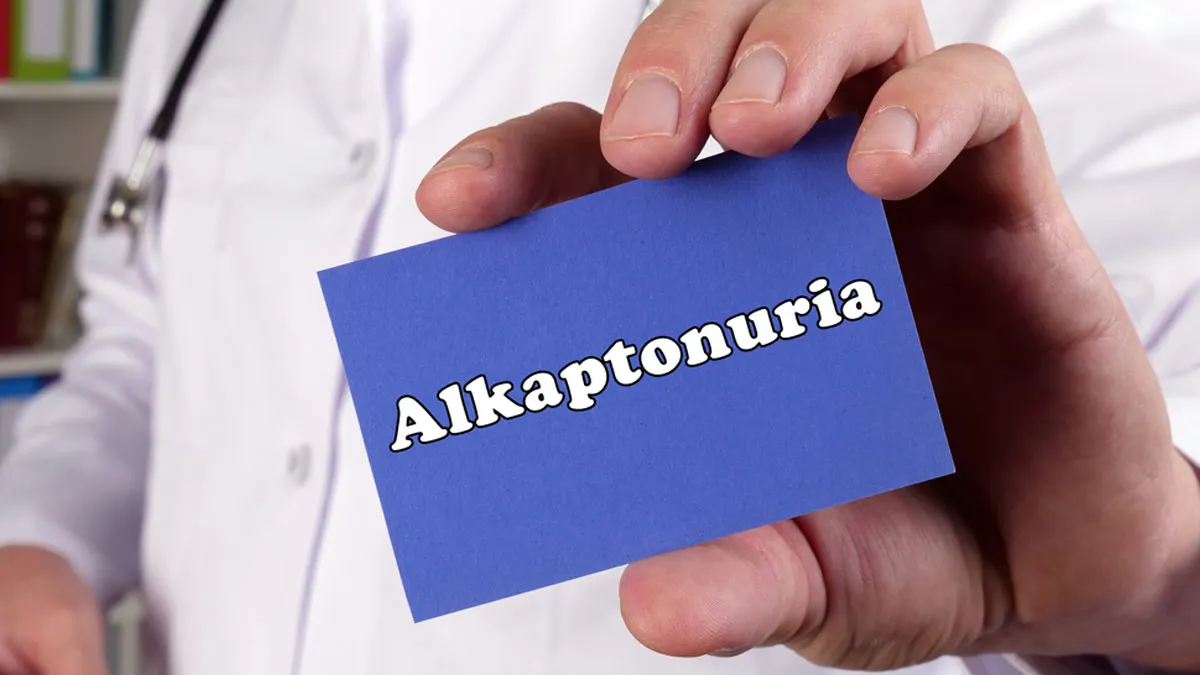 Alkaptonuria: Causes, Symptoms, Diagnosis, and Treatment Options Explained