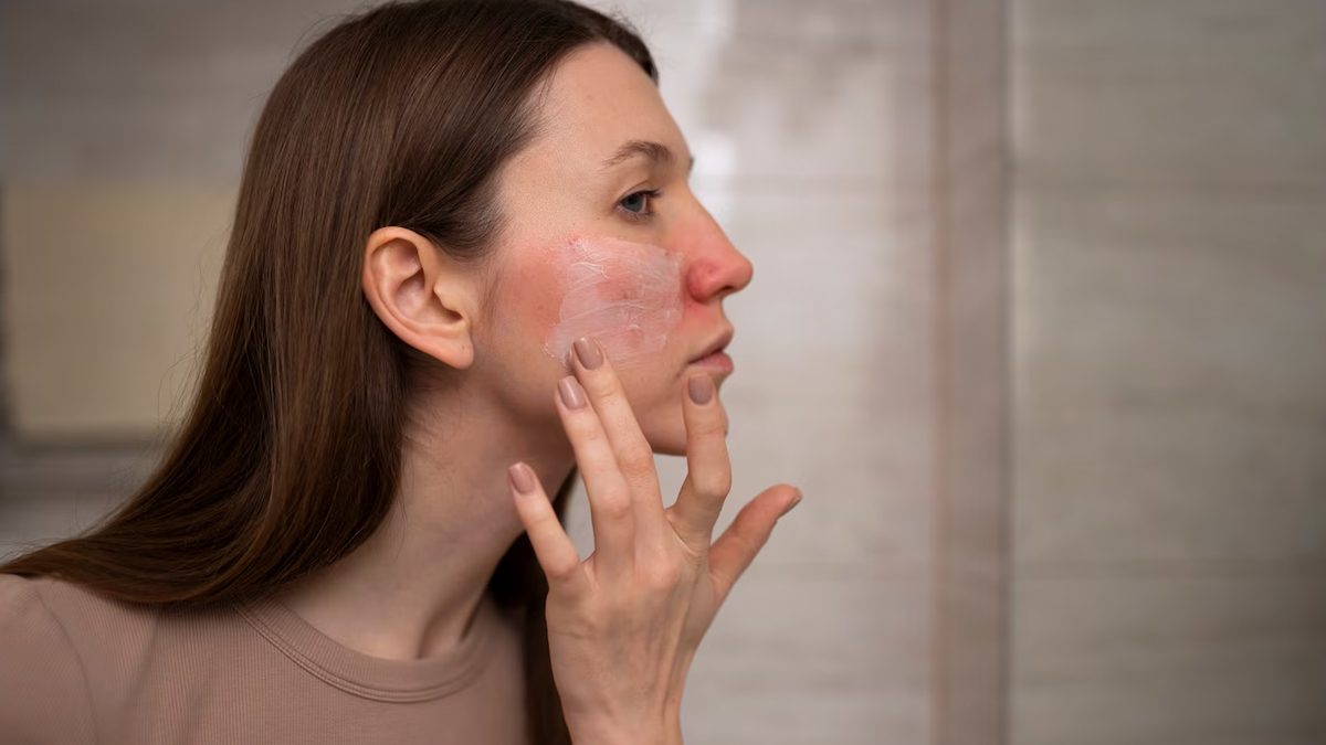 skin-inflammation