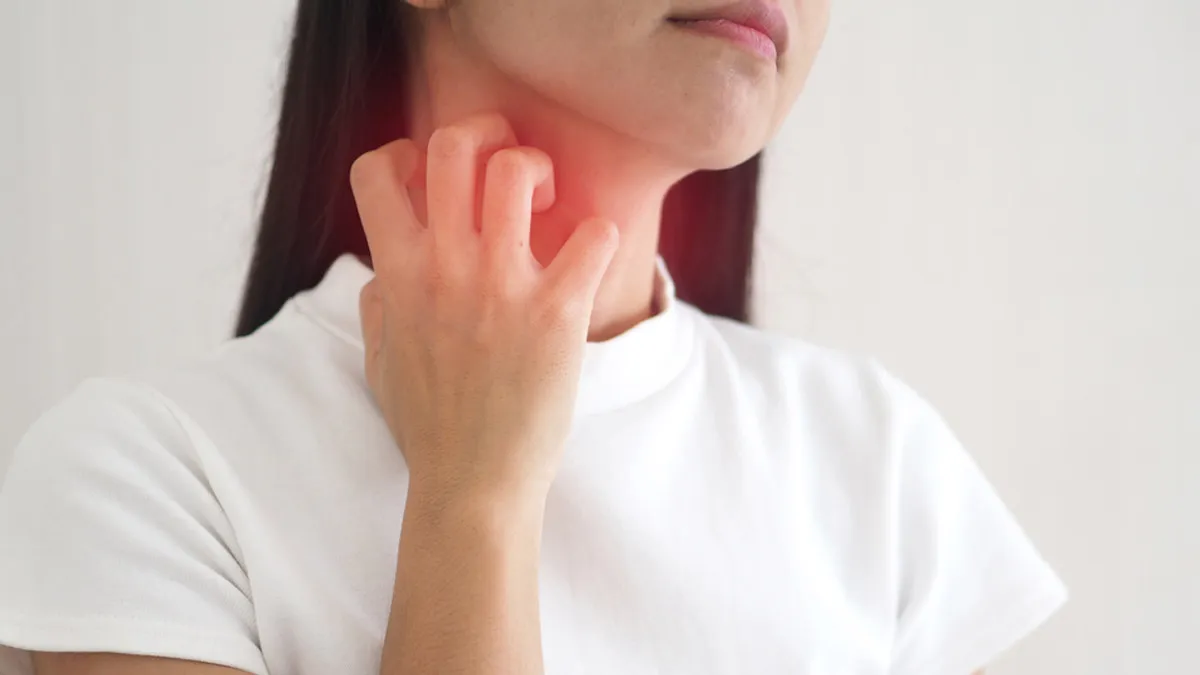From Cold Compress To Oatmeal Bath: Here Are 9 Home Remedies To Stop Hives From Itching