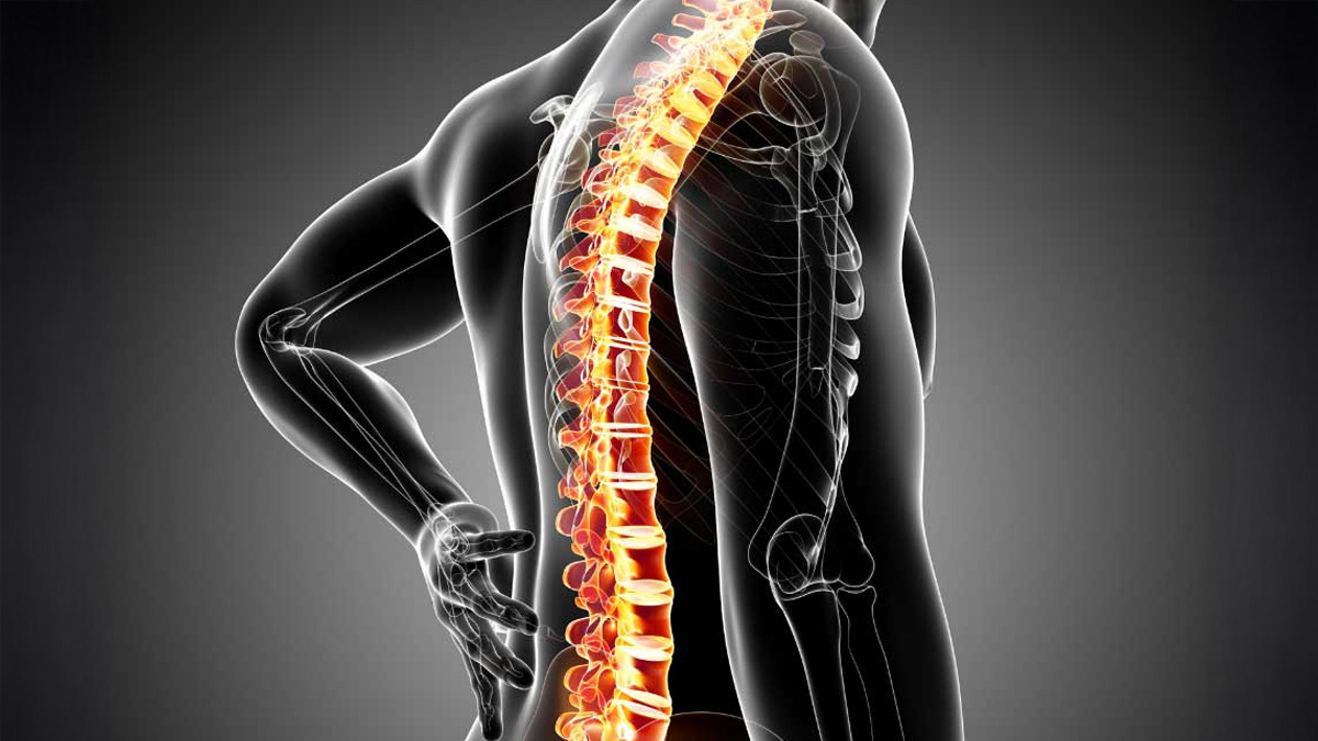 2-Axial-Spondylarthritis