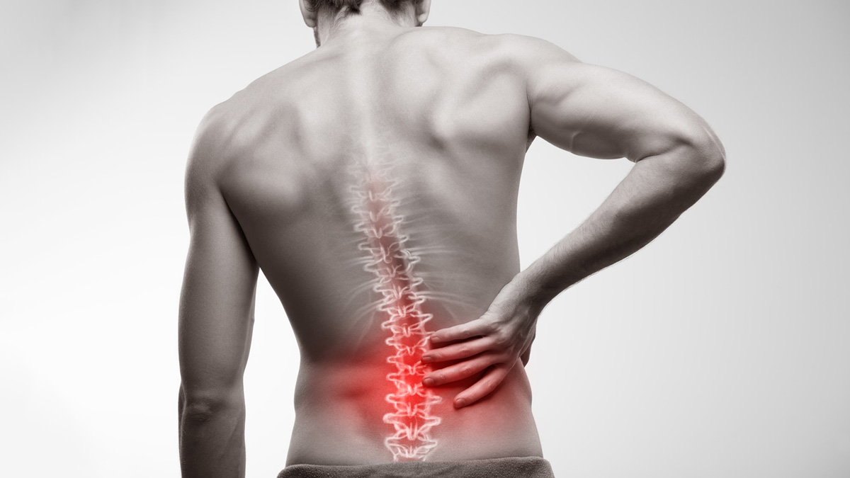 3-Axial-Spondylarthritis